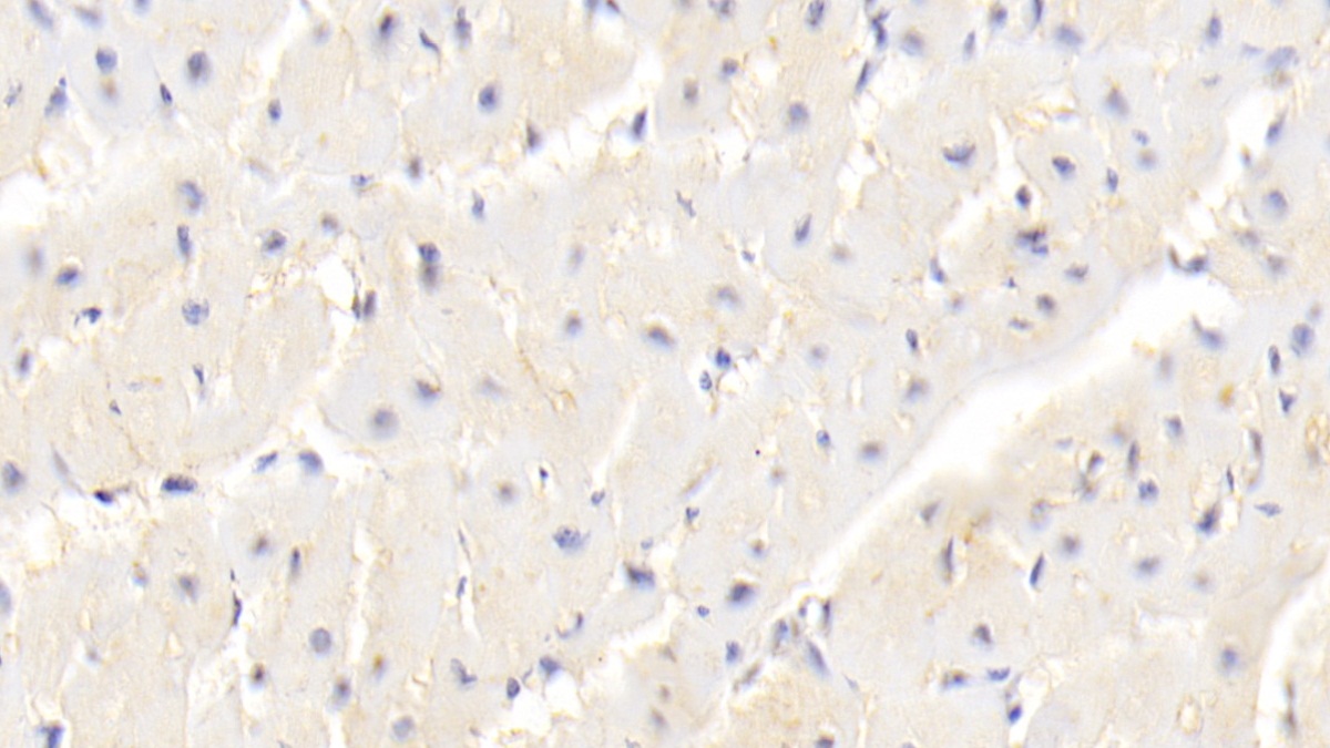 Polyclonal Antibody to Dysferlin (DYSF)