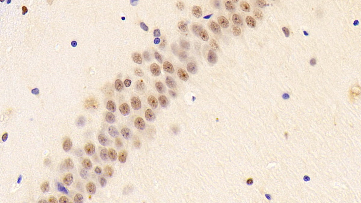 Polyclonal Antibody to Dyskerin (DKC)