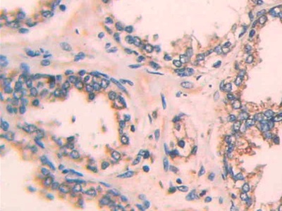 Polyclonal Antibody to Epithelial Cell Transforming Sequence 2 (ECT2)