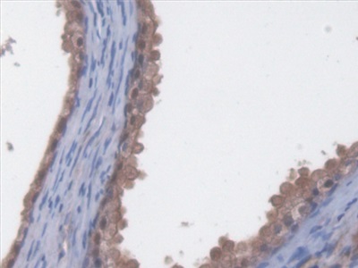 Polyclonal Antibody to Eukaryotic Translation Elongation Factor 2 (EEF2)