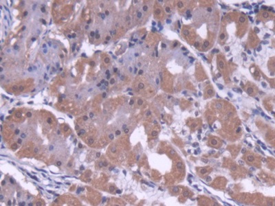 Polyclonal Antibody to Cytosolic Ovarian Carcinoma Antigen 1 (COVA1)