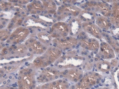 Polyclonal Antibody to Cytosolic Ovarian Carcinoma Antigen 1 (COVA1)