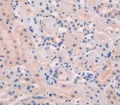 Polyclonal Antibody to Endothelial Cell Specific Molecule 1 (ESM1)