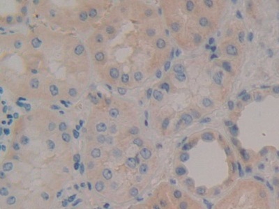 Polyclonal Antibody to Nidogen (NID)