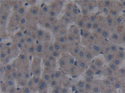 Polyclonal Antibody to Fibroblast Activation Protein Alpha (FAPa)