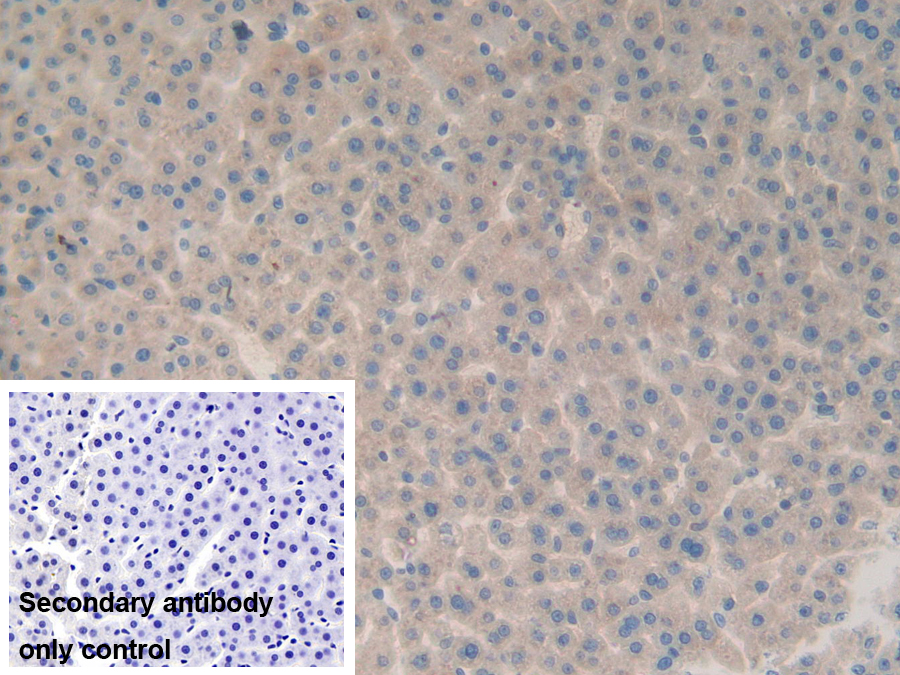 Polyclonal Antibody to Fibulin 1 (FBLN1)