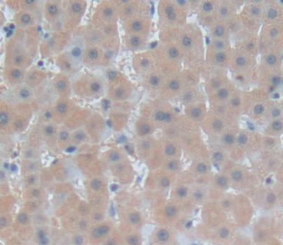 Polyclonal Antibody to Fibrosin (FBS)