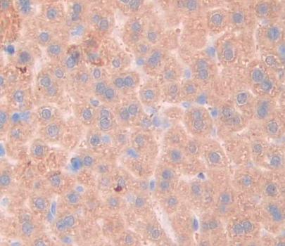 Polyclonal Antibody to Fibrosin (FBS)