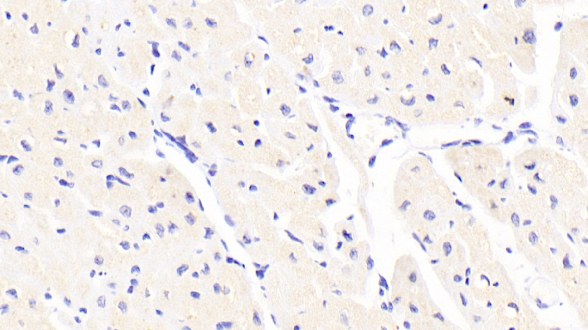 Polyclonal Antibody to Fibronectin Leucine Rich Transmembrane Protein 2 (FLRT2)