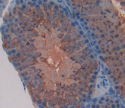 Polyclonal Antibody to Follicular Lymphoma Variant Translocation 1 (FVT1)