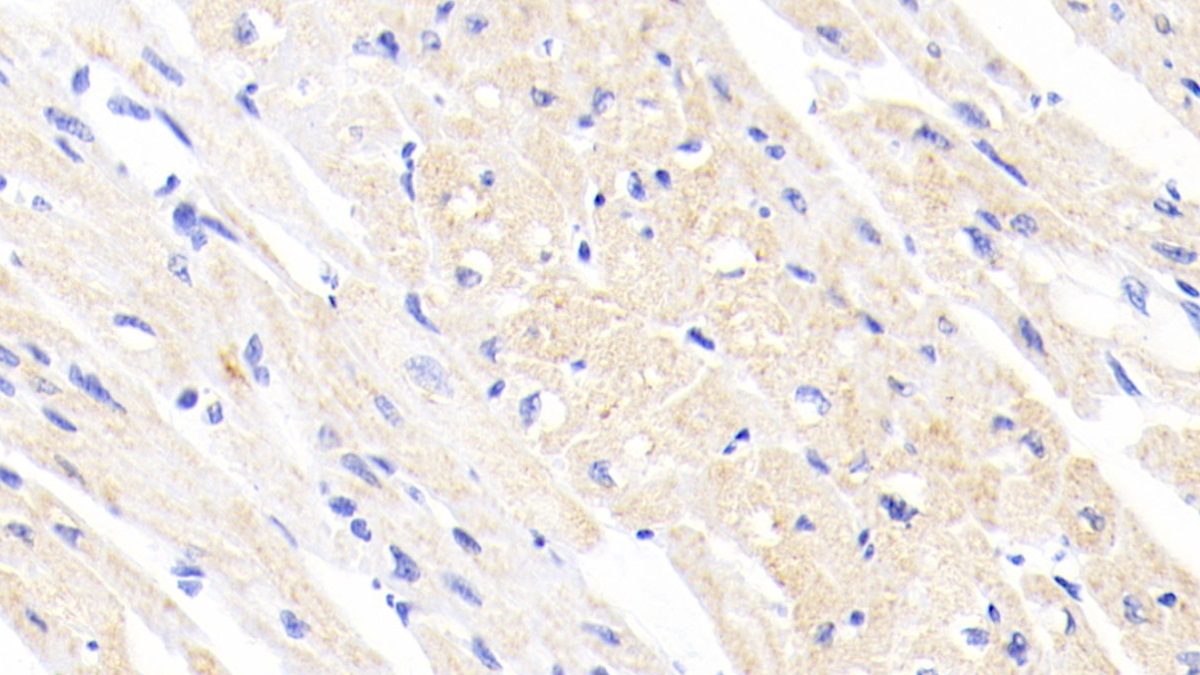 Polyclonal Antibody to Ferrochelatase (FECH)