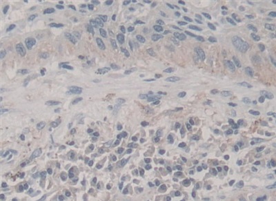 Polyclonal Antibody to Frataxin (FXN)