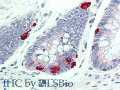 Polyclonal Antibody to Furin (FUR)