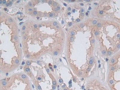 Polyclonal Antibody to Gastrokine 1 (GKN1)