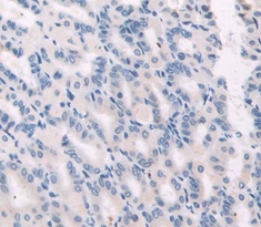 Polyclonal Antibody to Gastrokine 1 (GKN1)