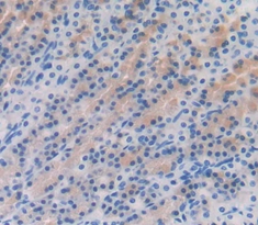 Polyclonal Antibody to Gastrokine 1 (GKN1)