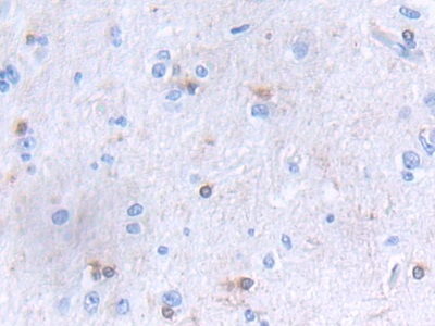 Polyclonal Antibody to Glycolipid Transfer Protein (GLTP)