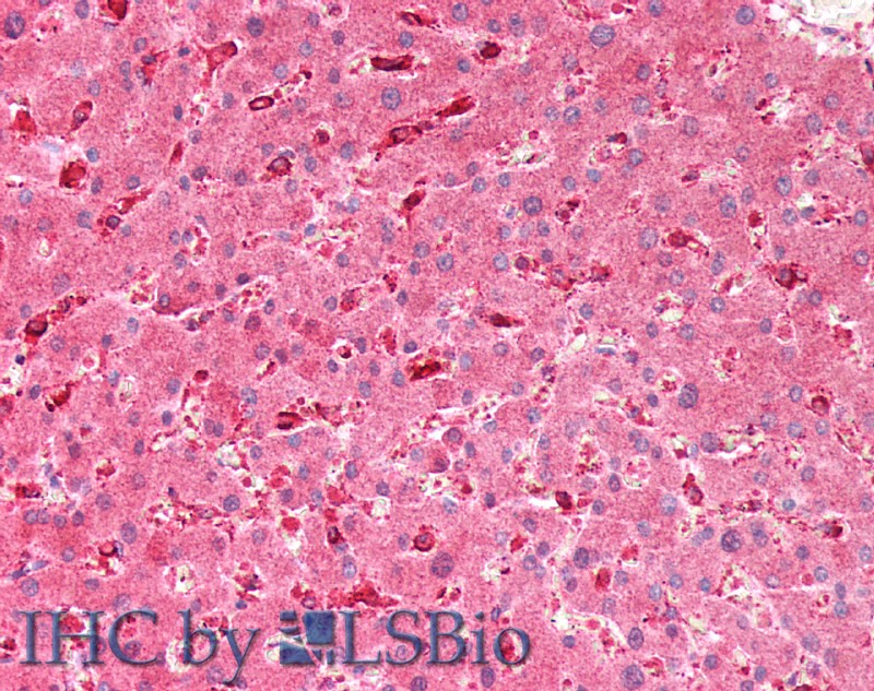 Polyclonal Antibody to Glucocerebrosidase (GBA)