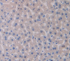 Polyclonal Antibody to Glucocerebrosidase (GBA)