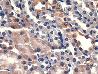 Polyclonal Antibody to Prostate-specific Membrane Antigen (PMSA)