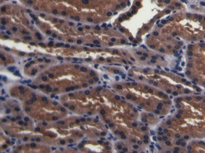 Polyclonal Antibody to Prostate-specific Membrane Antigen (PMSA)