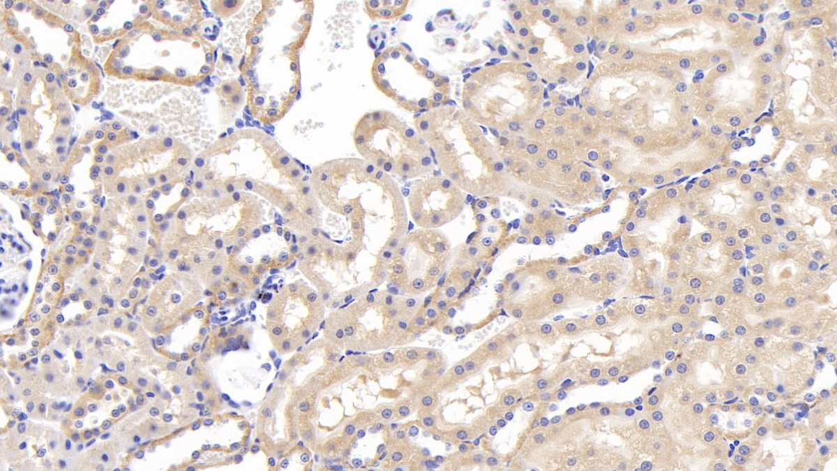 Polyclonal Antibody to Granulin (GRN)