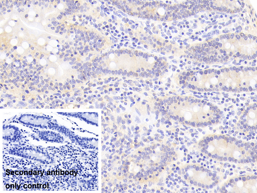 Polyclonal Antibody to Hyaluronan Binding Protein 2 (HABP2)