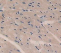 Polyclonal Antibody to Hemicentin 1 (HMCN1)