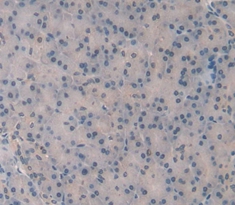 Polyclonal Antibody to 150 kDa Oxygen Regulated Protein (ORP150)