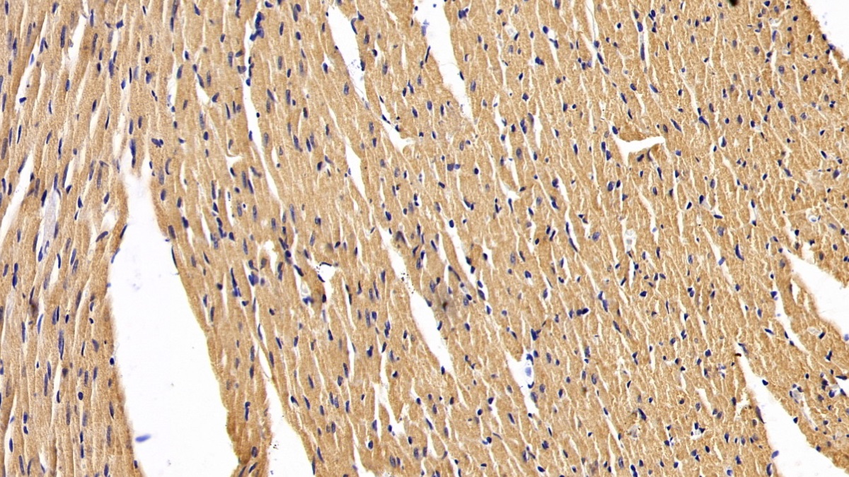 Polyclonal Antibody to Islet Cell Autoantigen 1 (ICA1)