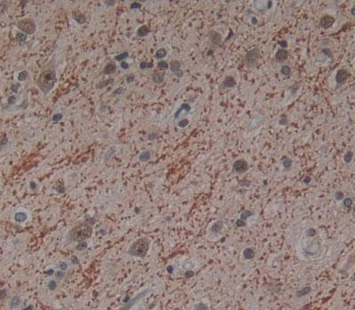 Polyclonal Antibody to Intestinal Cell Kinase (ICK)