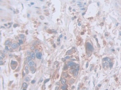 Polyclonal Antibody to Nephronophthisis 2, Infantile (NPHP2)