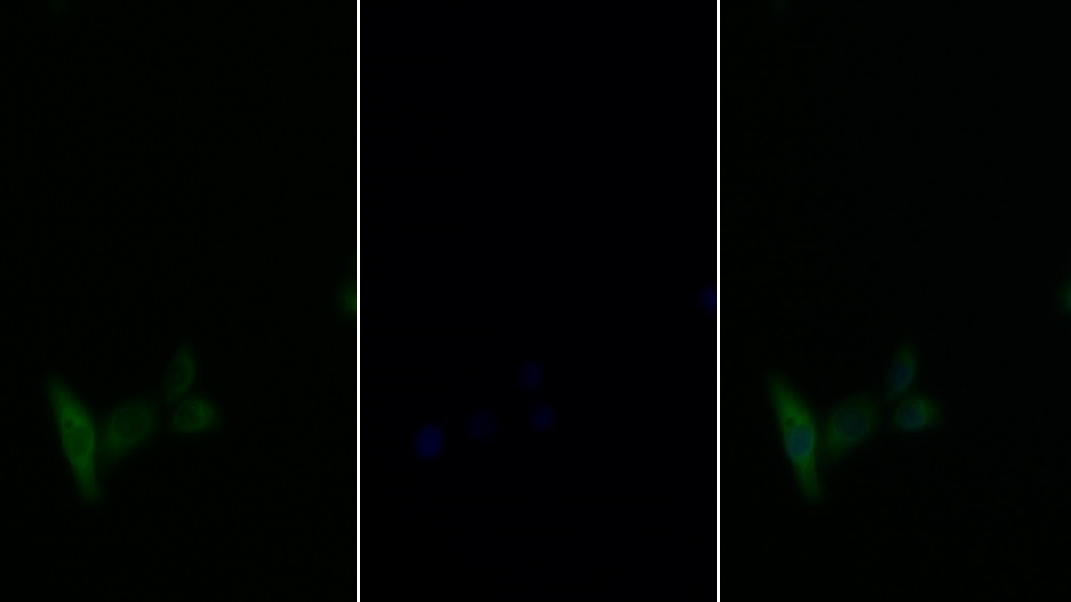 Polyclonal Antibody to Insulin Receptor Substrate 1 (IRS1)