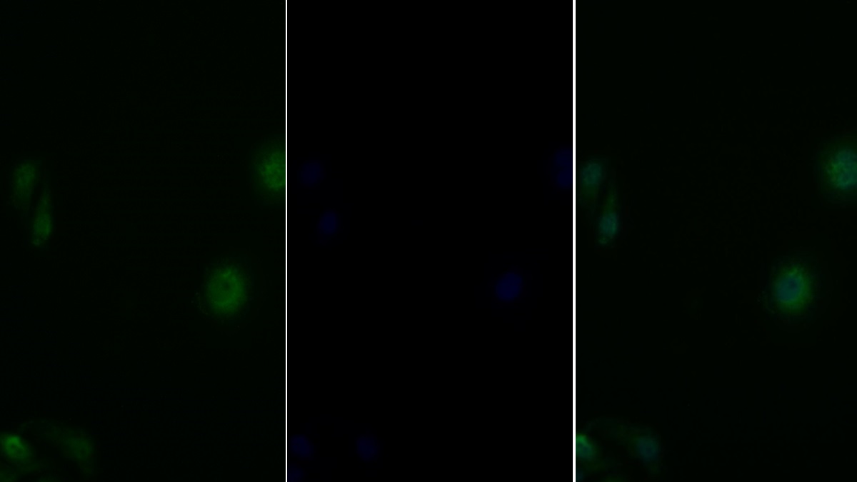 Polyclonal Antibody to Insulin Receptor Substrate 1 (IRS1)