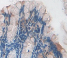 Polyclonal Antibody to Inosine Triphosphatase Pyrophosphatase (ITPA)