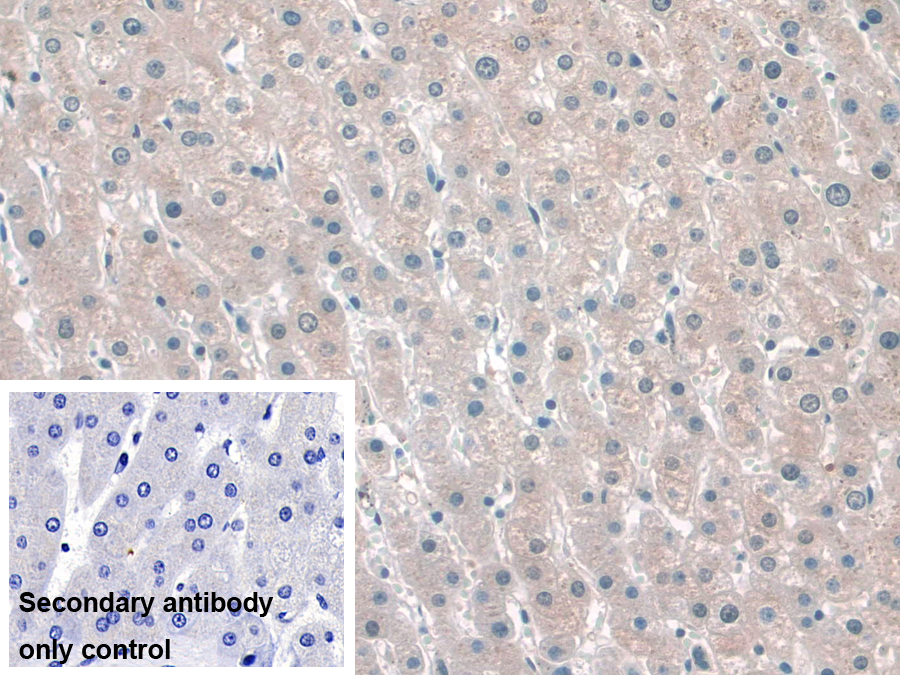 Polyclonal Antibody to Katanin P60 Subunit A 1 (KATNA1)