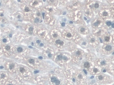 Polyclonal Antibody to Katanin P60 Subunit A 1 (KATNA1)