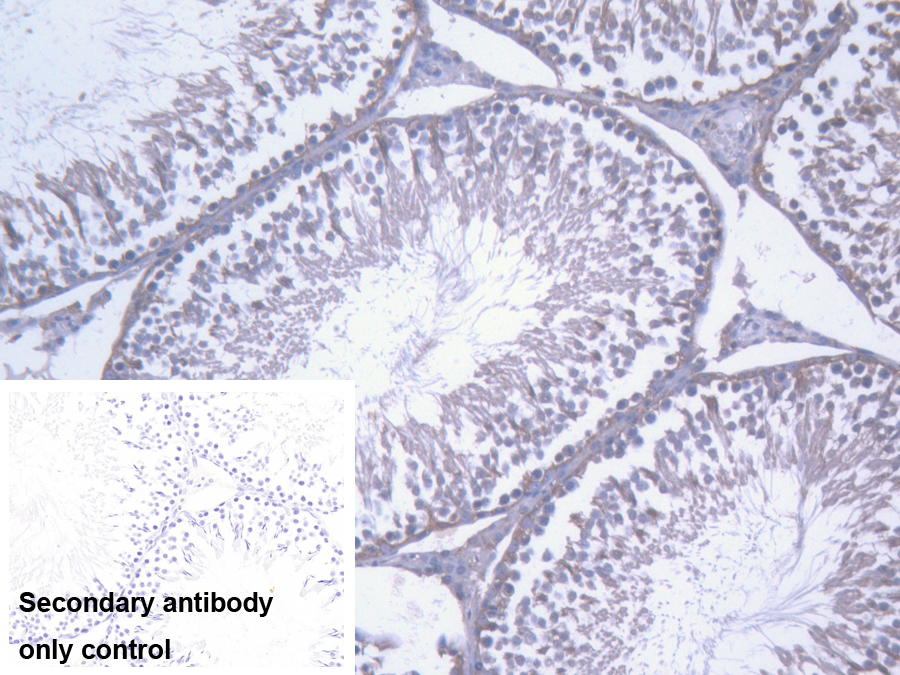 Polyclonal Antibody to Kinectin 1 (KTN1)