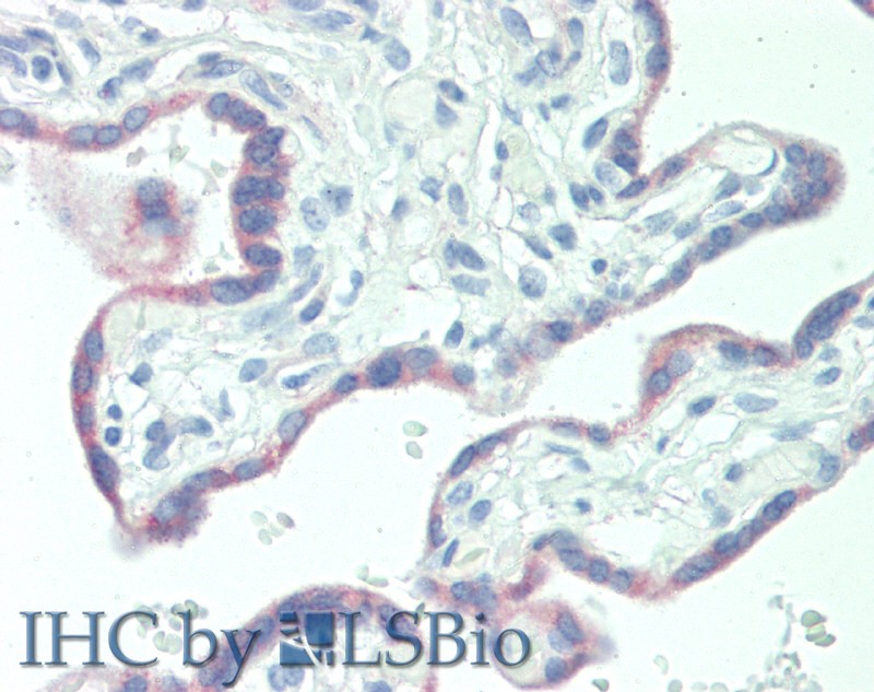 Polyclonal Antibody to Kisspeptin 1 (KISS1)