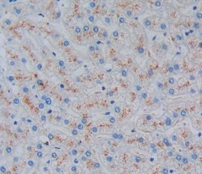 Polyclonal Antibody to Ladinin 1 (LAD1)