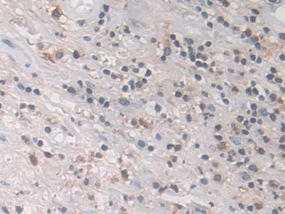 Polyclonal Antibody to L-Plastin (LCP1)