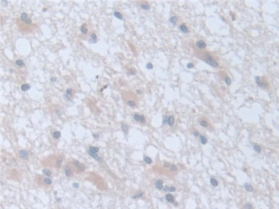 Polyclonal Antibody to Leucine Zipper, Down Regulated In Cancer 1 (LDOC1)