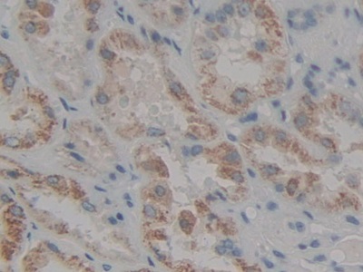 Polyclonal Antibody to Loricrin (LOR)