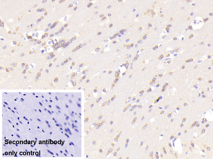 Polyclonal Antibody to Leucine Rich Repeats And Death Domain Containing Protein (LRDD)