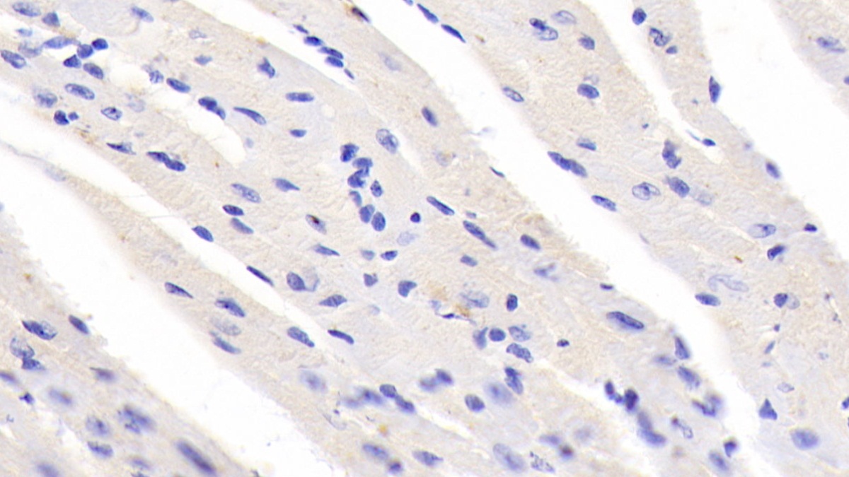 Polyclonal Antibody to Ubiquitin Associated Protein 1 (UBAP1)