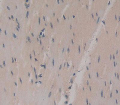 Polyclonal Antibody to Uridine Cytidine Kinase 2 (UCK2)