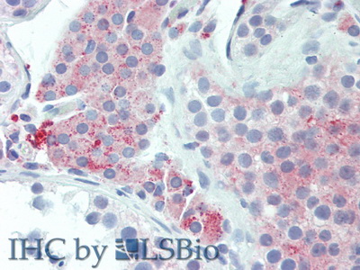 Polyclonal Antibody to Urocortin 2 (UCN2)