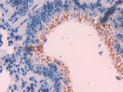 Polyclonal Antibody to Mitochondrial Uncoupling Protein 2 (UCP2)