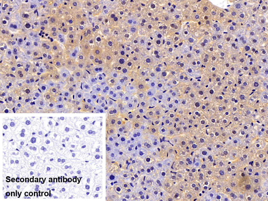 Polyclonal Antibody to Beta-ureidopropionase (UPB1)