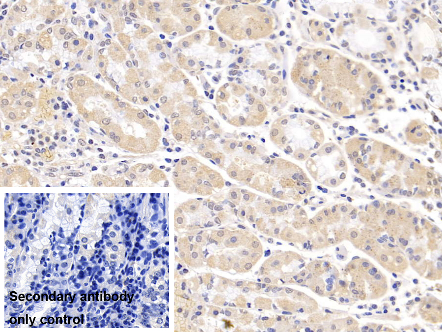 Polyclonal Antibody to Villin (VIL)